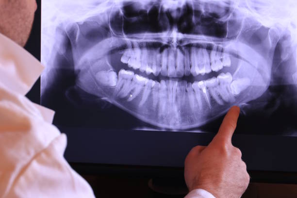 Best Emergency Dental Services Near Me  in Kean University, NJ