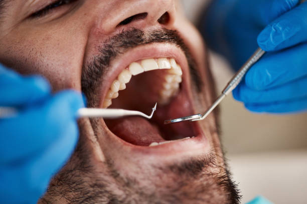 Best Emergency Dental Filling Replacement  in Kean University, NJ