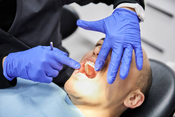 Best Dentist for Tooth Abscess  in Kean University, NJ