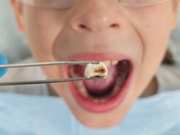 Best Emergency Dentist Near Me  in Kean University, NJ